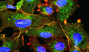 confocal image